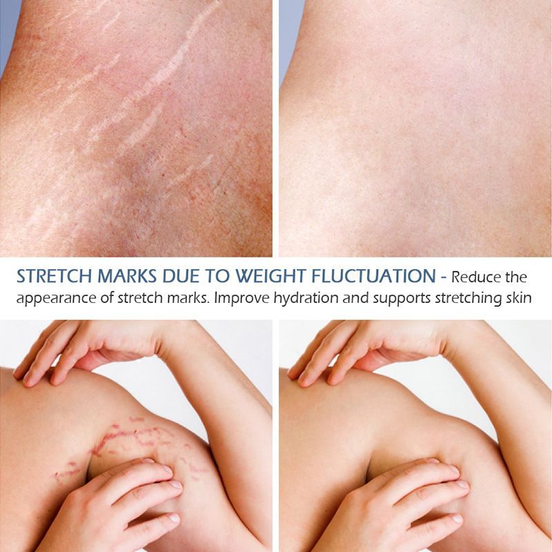 Transform Your Skin with Confidence